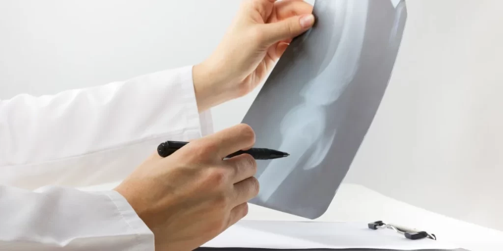 ORTHOPEDIC doctor bhiwandi